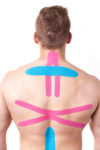 Aku-taping kann eine Schmerztherapie unterstützen.